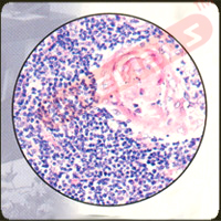 Human Thymus - Fetal, sec.